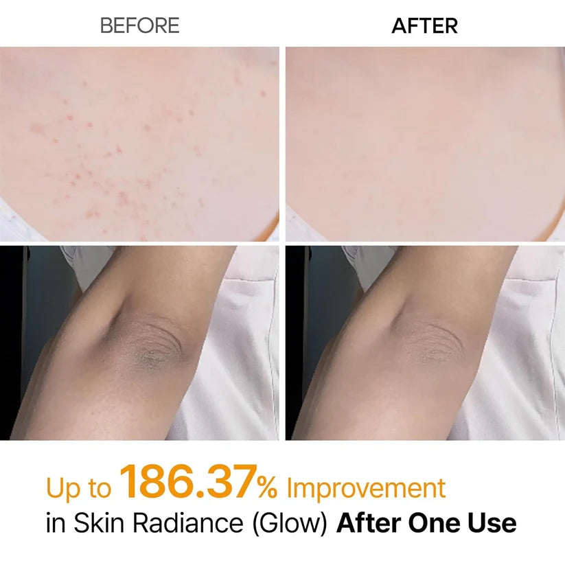 Dr.Melaxin Peel Shot Kojic Acid & Turmeric Body Exfoliating Spray 200ml