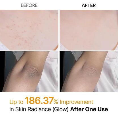 Dr.Melaxin Peel Shot Kojic Acid & Turmeric Body Exfoliating Spray 200ml